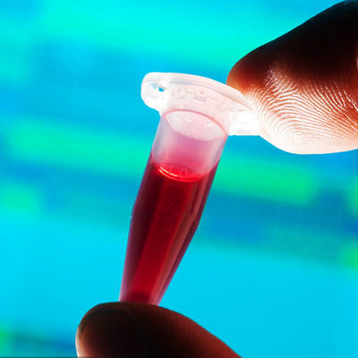 Laboratoria testowe zatwierdzone przez FDA Szybkie wykrywanie Kontakt z żywnością Butelka dla niemowląt Usługa uwierzytelniania innej firmy